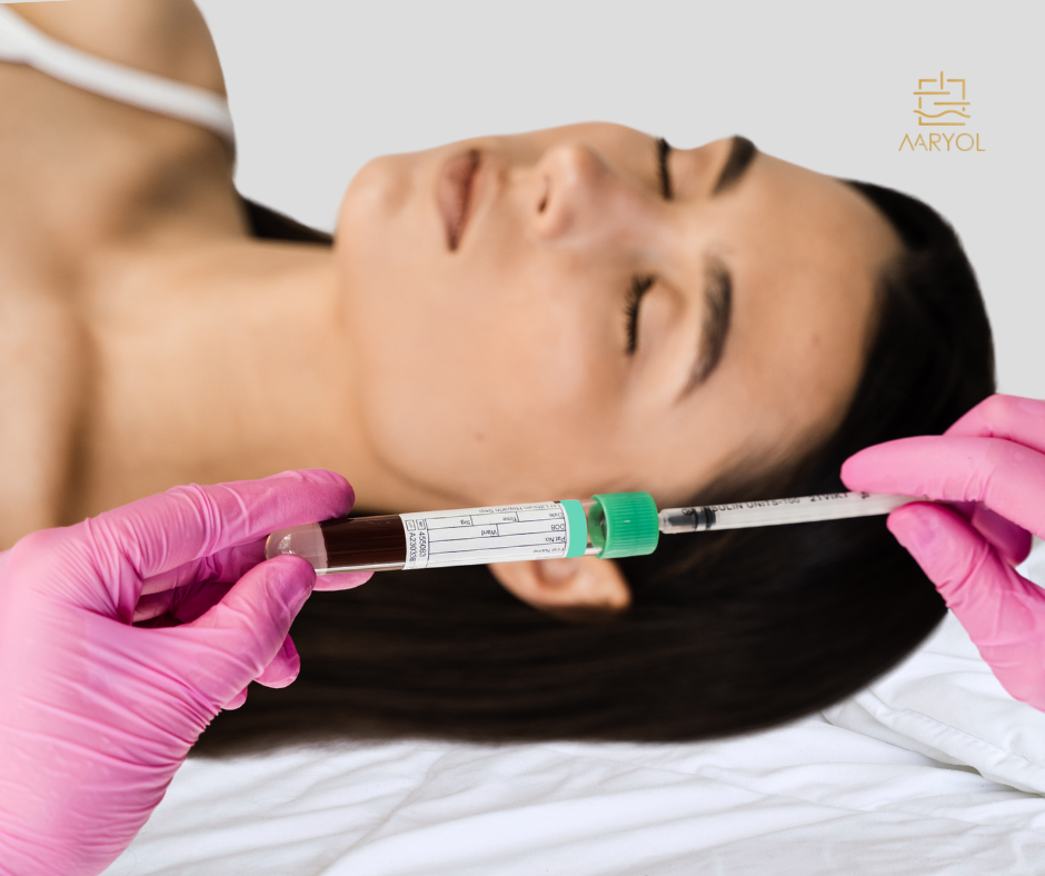 Plasma Rico en Plaquetas (PRP) en Lima: Beneficios y Aplicaciones en Estética