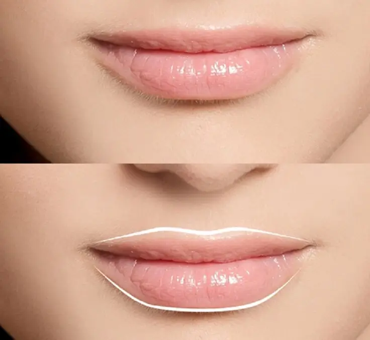 Pigmentación de Labios en Lima: Tratamiento para un Color Natural