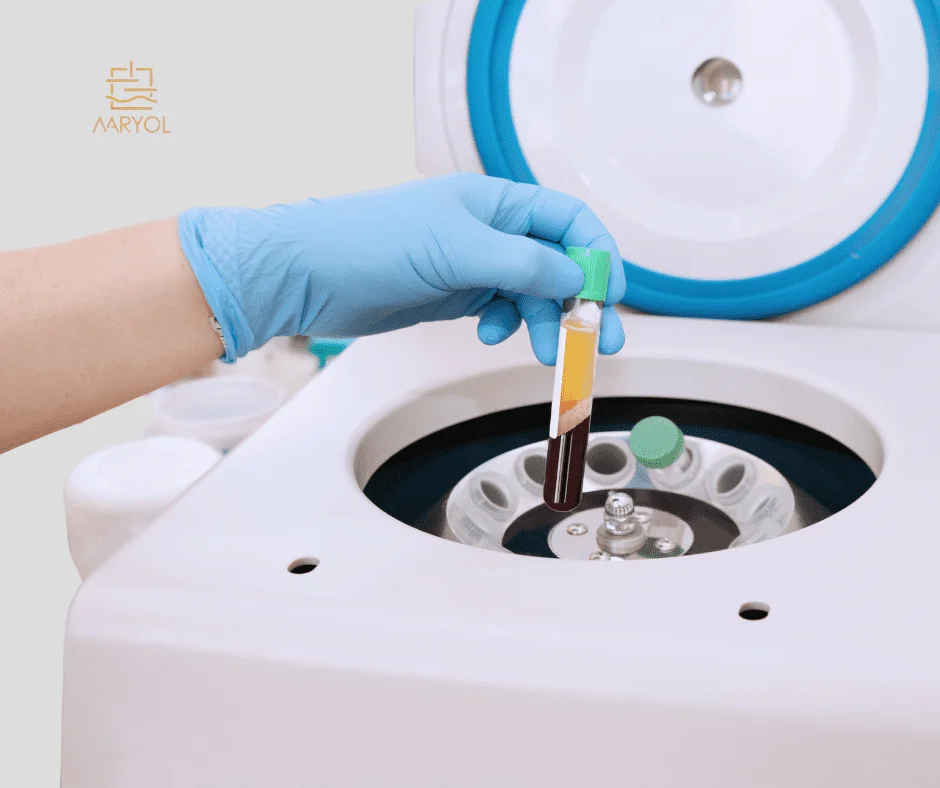 1. Aplicación de plasma en el rostro Antes y después