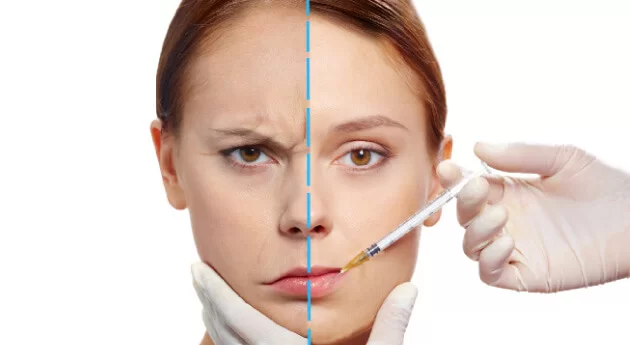 Toxina Botulínica para el rostro