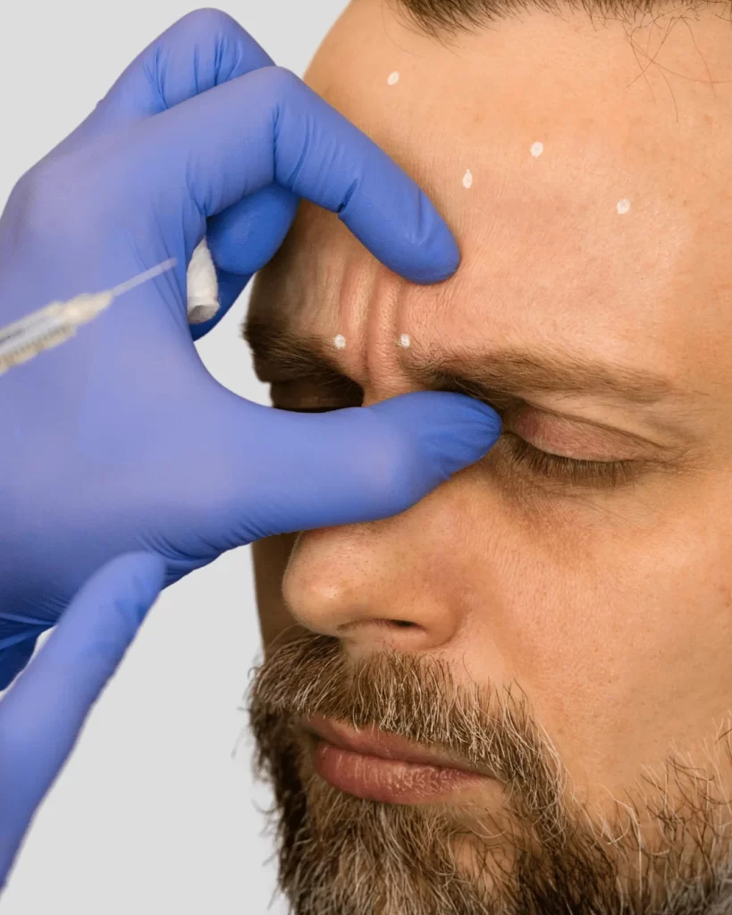Aplicación de Botox