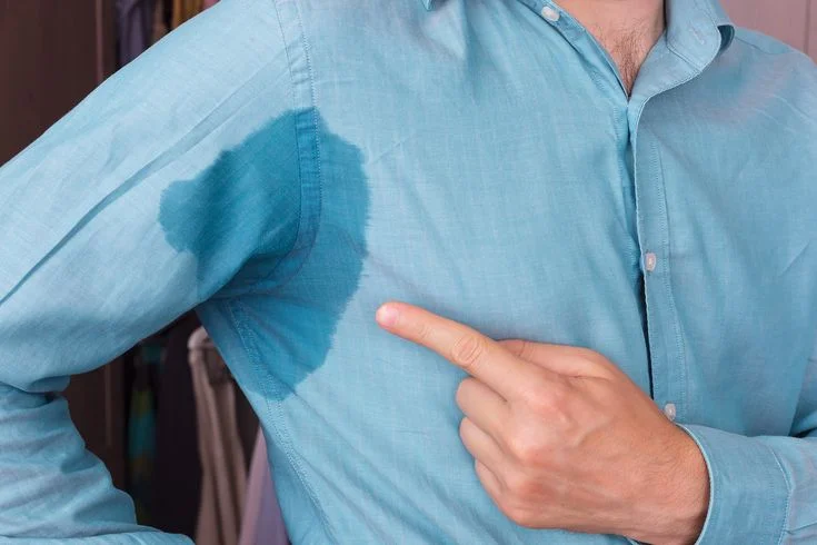 Tratamiento médico para hiperhidrosis con toxina botulínica