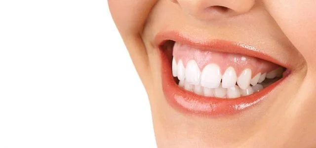 Corrección estética de sonrisa gingival con toxina botulínica