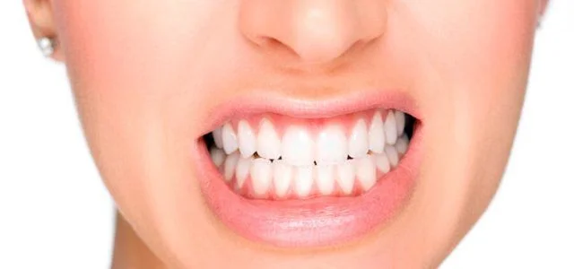 Bruxismo: reducción del dolor mandibular y de cabeza con toxina botulínica
