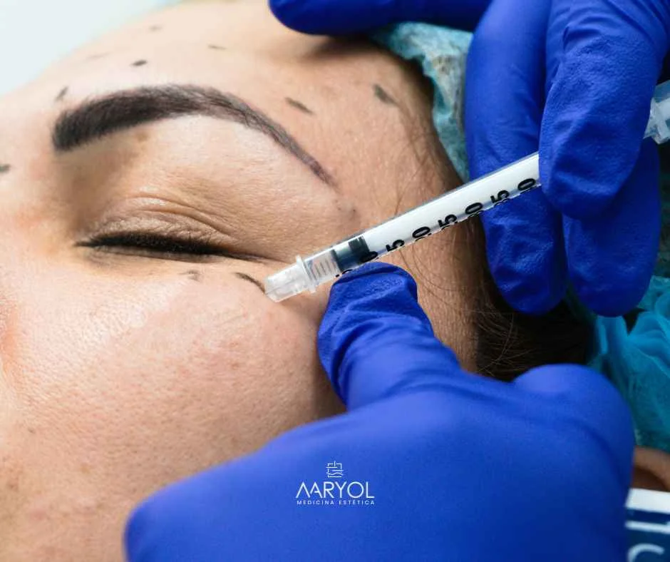 Beneficios de la toxina botulínica full face: resultados naturales y armónicos