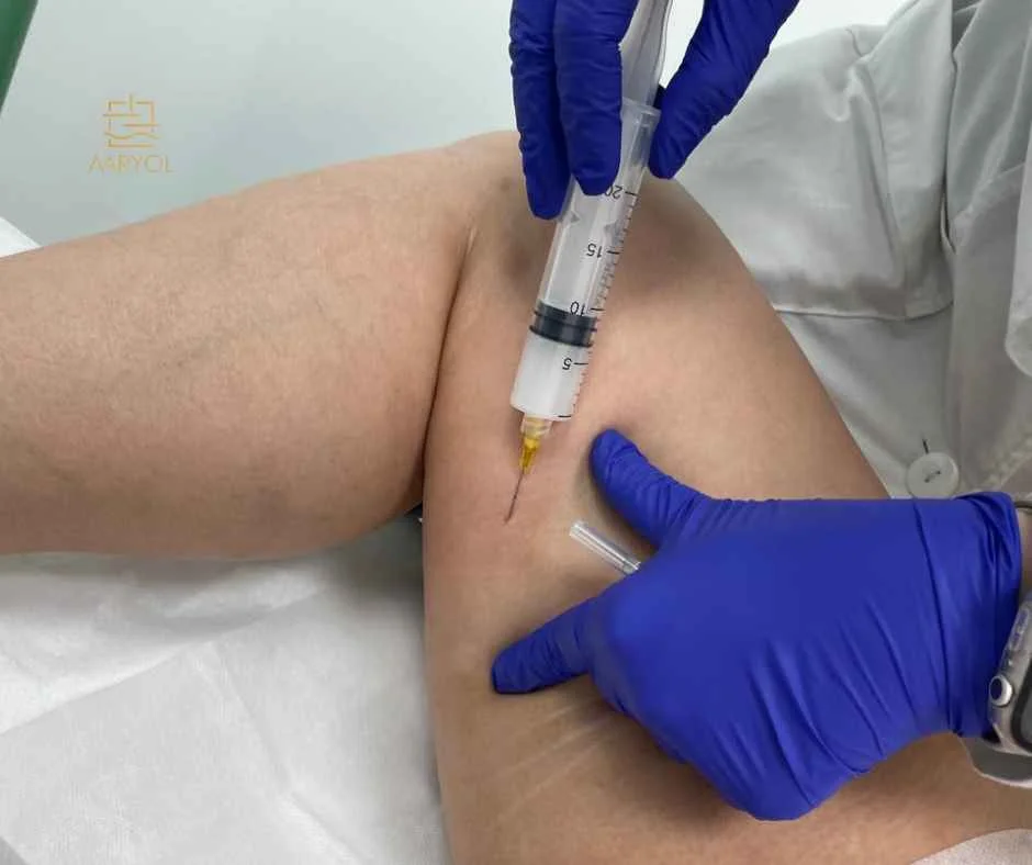 Reducción de celulitis en Lima Perú