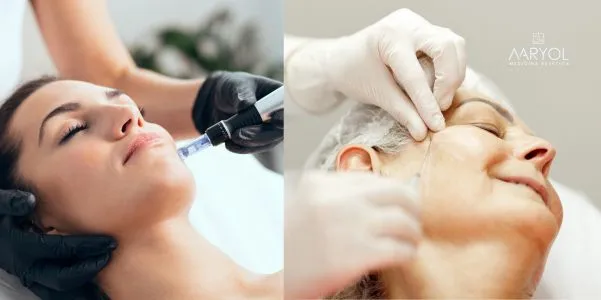 Skinbooster Vs Bioestimuladores en Lima Perú