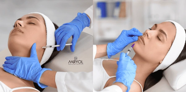 ¿Relleno facial o bioestimulación? Cuál necesitas realmente