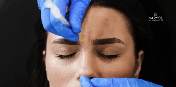 ¿Cuál es la edad ideal para aplicar toxina botulínica por primera vez?